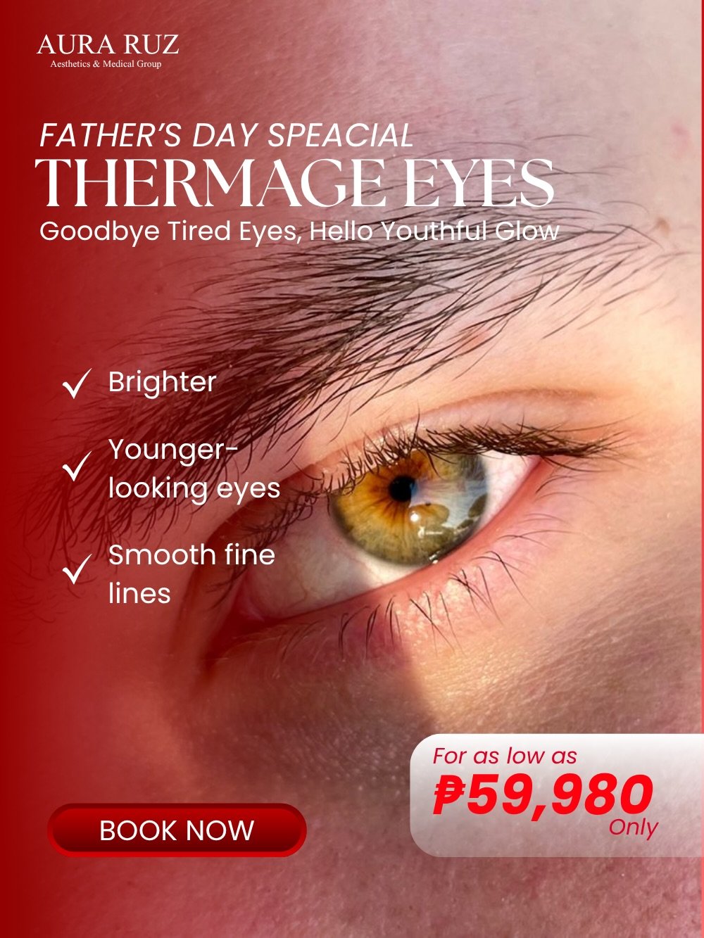 Thermage Eyes