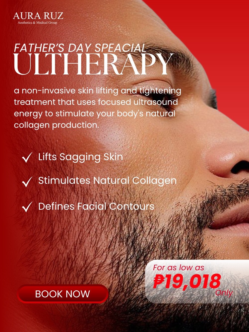 Ultherapy